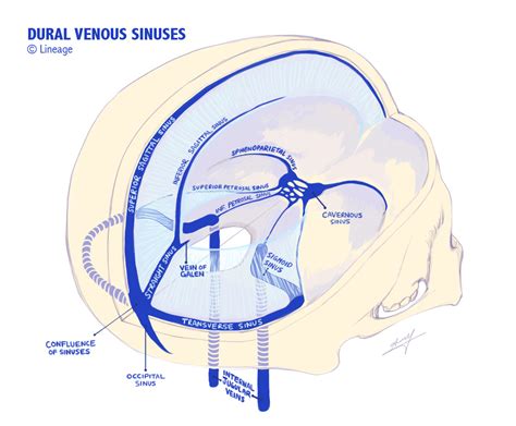 Dural Venous Sinuses