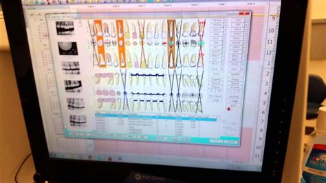 Eaglesoft Dental Software Manual