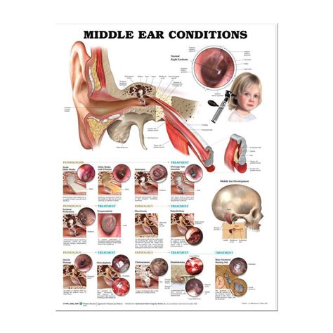 Ear Laminated Poster