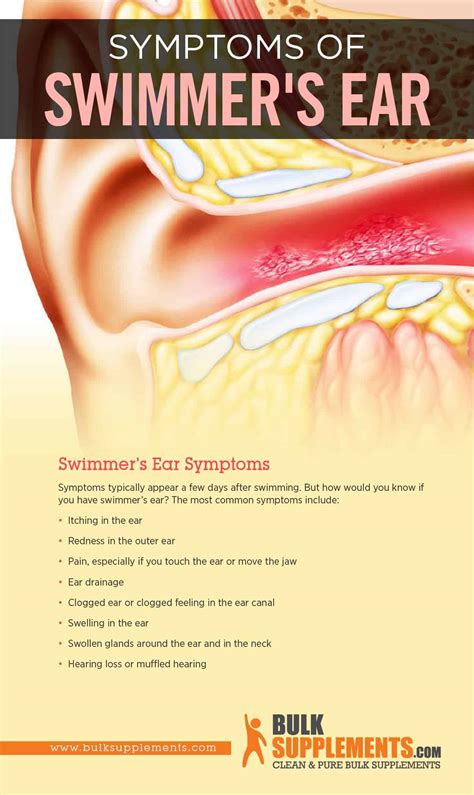 Download Ear Pain Ear Pain Due To Ear Barotrauma Swimmers Ear Surfers Ear Cold In The Ear Ear Infection And Tinnitus Causes Prevention And Treatment In Detail 