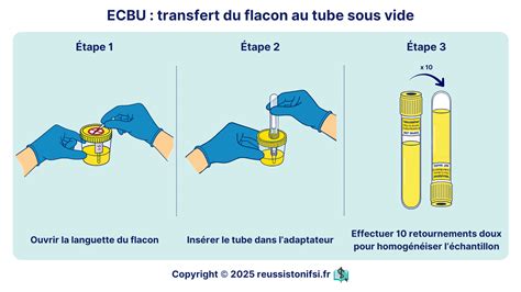 Ecbu Avec Atbg