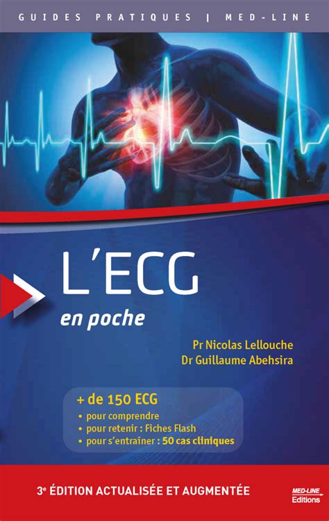 Ecg De Poche
