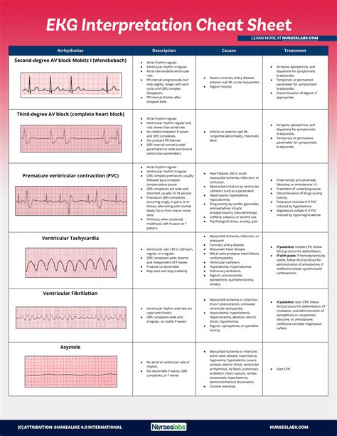 Ecg Interpretation Cheat Sheet