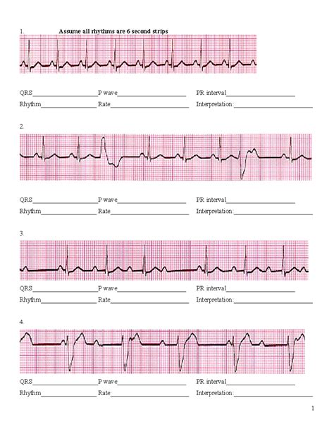 Ecg Interpretation Practice Strips Bing Pdfsdir