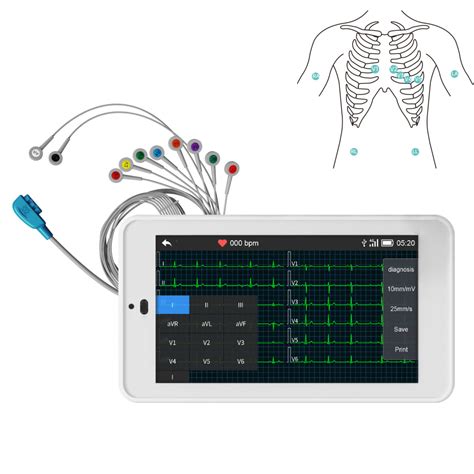Ecg Monitoring And Analyses In Mice Springer