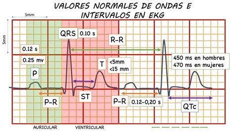 Ecg Normal Valores