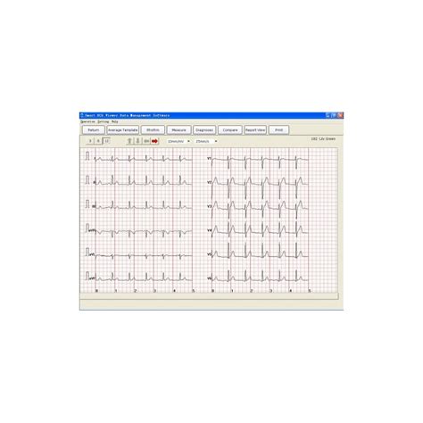 ecg viewer software easy pc 80 16