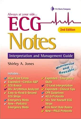 Read Ecg Notes Interpretation And Management Guide 