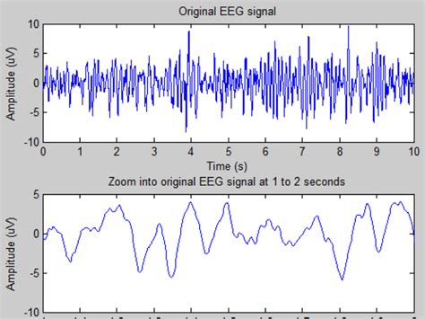 Eeg Analysis Using Matlab