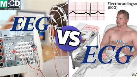 Eeg Vs Ecg