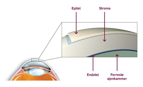 efter starr operation