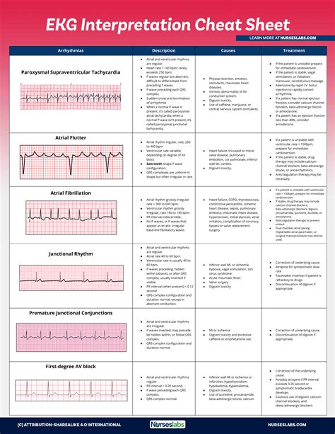 Ekg Cheat Sheet Pdf