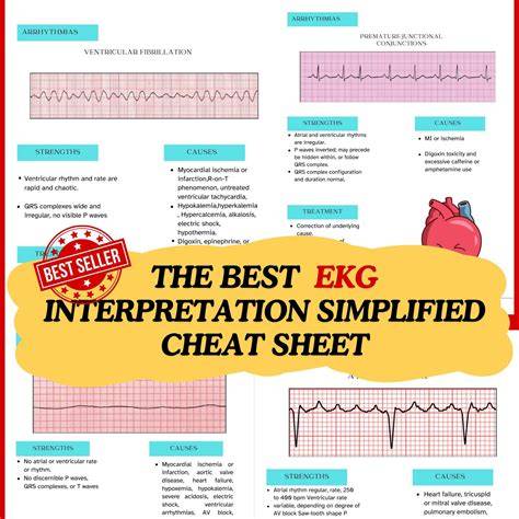 ekg interpretation overlay