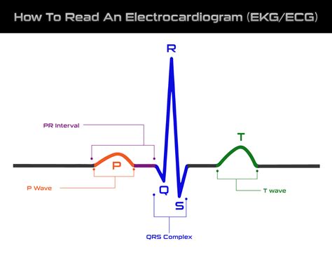 ekg p