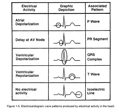 Download Ekg Interpretation Basics Guide Electrocardiogram Heart Rate Determination Arrhythmia Cardiac Dysrhythmia Heart Block Causes Symptoms Identification And Medical Treatment Nursing Handbook 