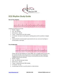 Full Download Ekg Rhythms Study Guide 