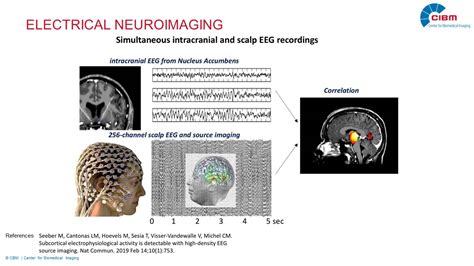 Electrical Neuroimaging