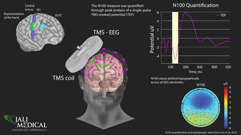 electro-encefalogram uitleg