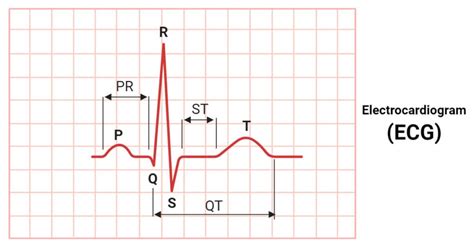 electrocardiogram