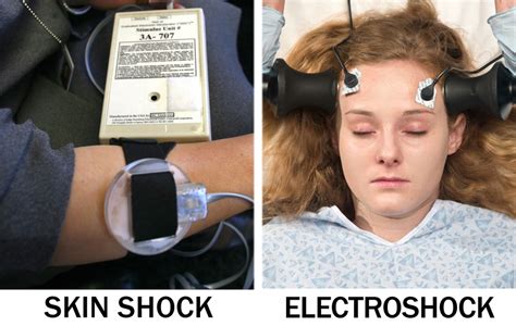 electroshock-1