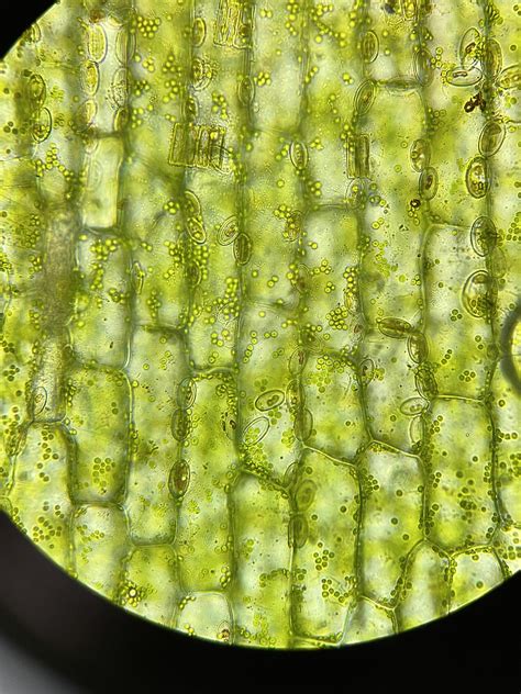 Elodea Cell Under Microscope