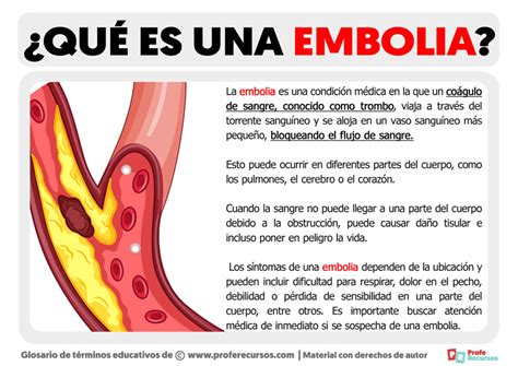 Embolismo Que Es