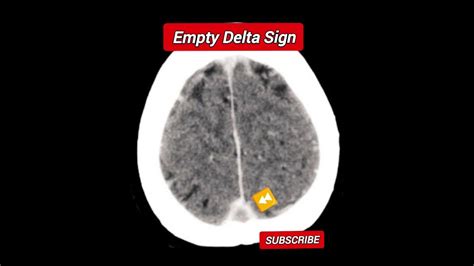 Empty Delta Sign