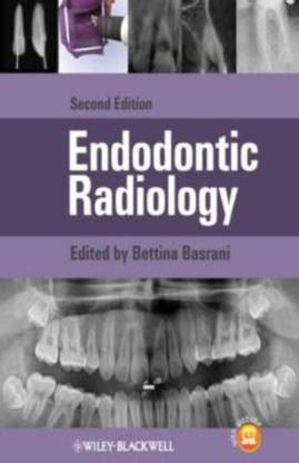 Full Download Endodontic Radiology 2Nd Edition 