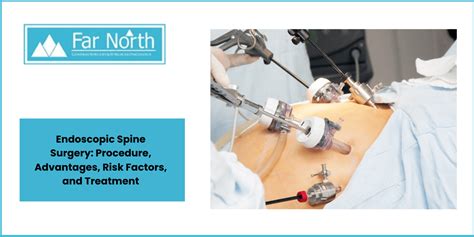 Endoscopic Spinal Surgery 1st First Edition By Lewandrowski Kai Uwe Md Lee Sang Ho Md Phd Ipre Published By Jp Medical Publishers 2013