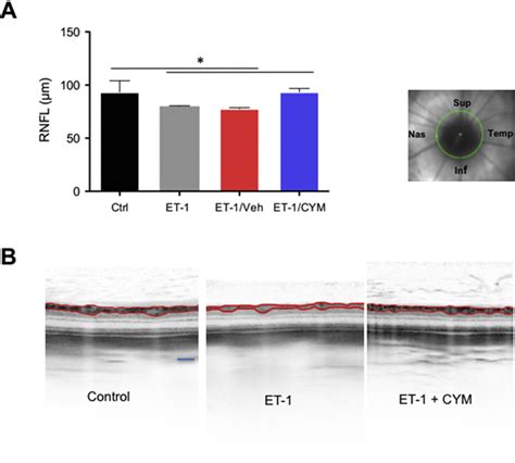 Endothelin 1 Induced Retinal Ganglion Cell Death Is Largely Mediated By Jun Activation - Mahong4d