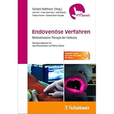 endovenose verfahren