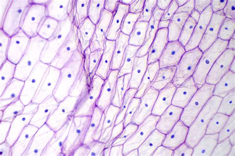 Epidermis De Cebolla