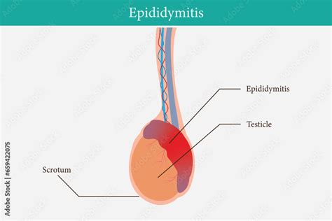Epididimis