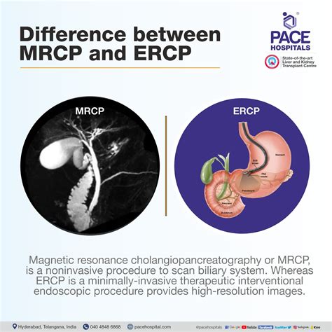 Ercp Vs Mrcp