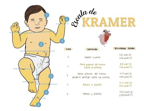Escala De Kramer