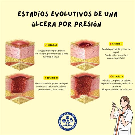 Escala De Upp