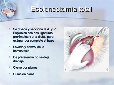 esplenectomia-1