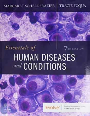 Full Download Essentials Of Human Diseases And Conditions Workbook Answer Key Chapter 11 