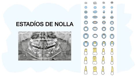 Estagio De Nolla