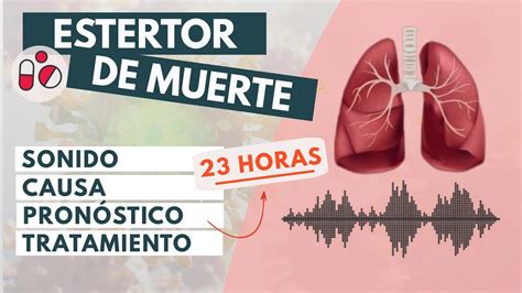 Estertor De Muerte