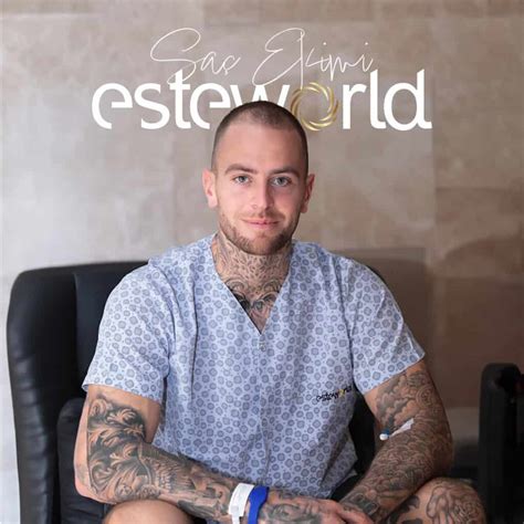 Esteworld Saç Ekimi