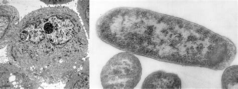 Eukaryotic Cells Under Microscope