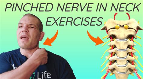 exercises for a trapped nerve in neck