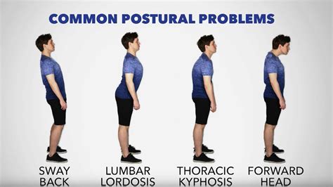 exercises to improve sway back posture