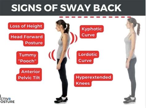 exercises to improve sway back posture