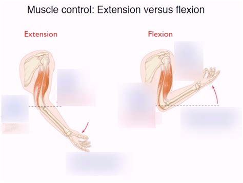 Extension Versus Flexion