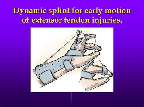 extensor tendon laceration rehabilitation
