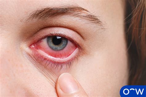 Eye Of Pain