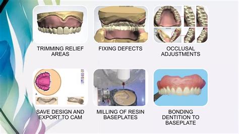 Fabrication Of Complete Dentures Using Cad Cam Technology