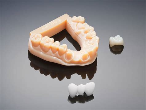Fabrication Prothèse Dentaire 3d    - Fabrication Prothèse Dentaire 3d